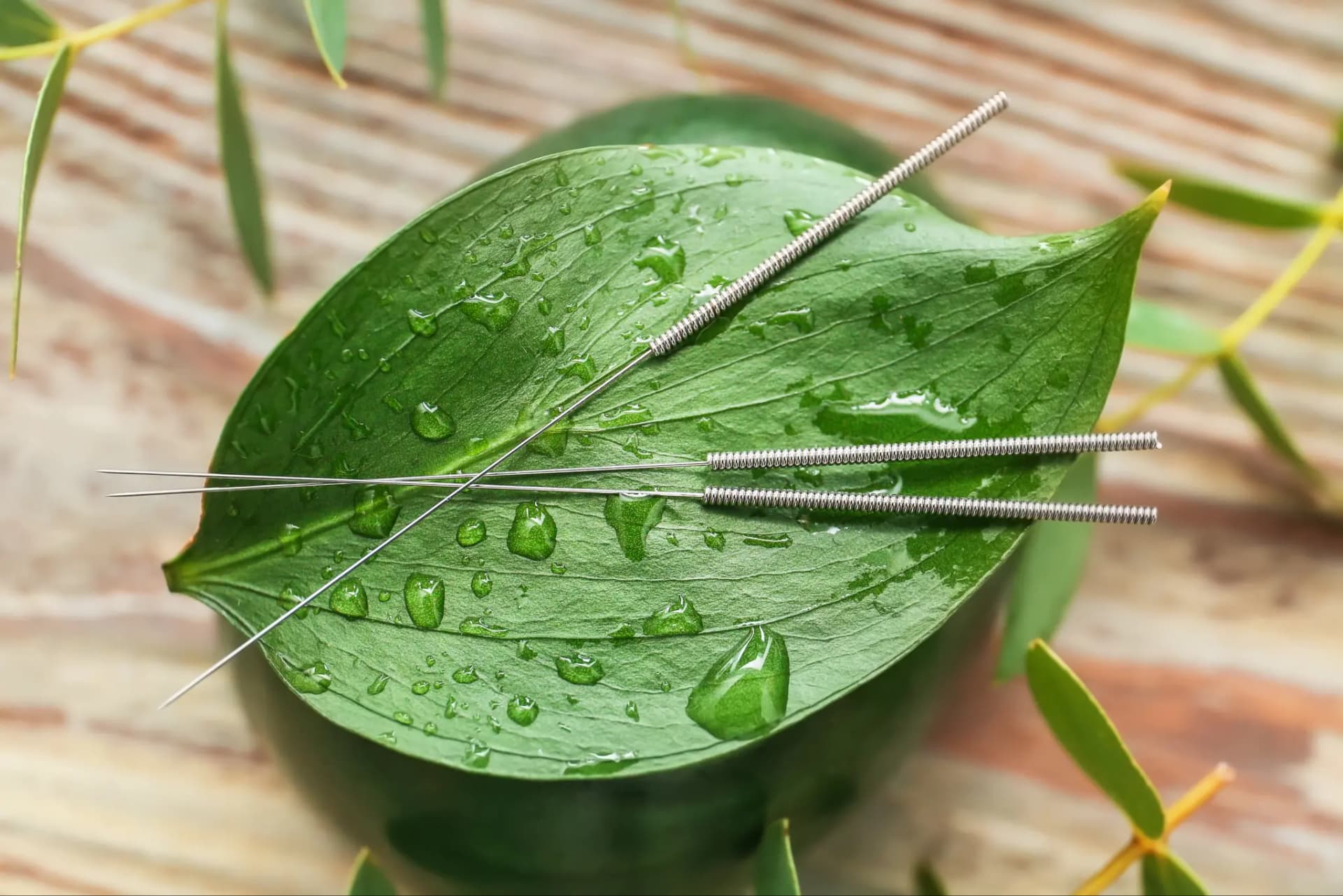Acupuncture treatment at Swasi Healthcare
