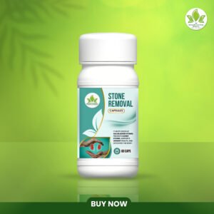 new products13 Stone Removal